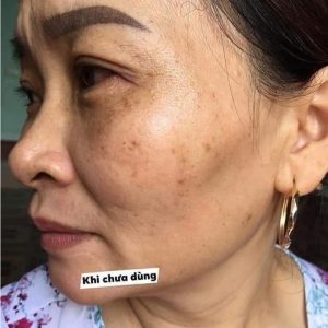 Da khách khi chưa dùng vua nám huyền phi